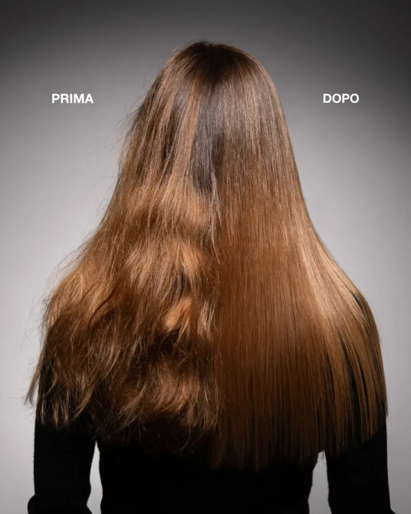 nanoplastia prima dopo